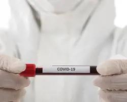 Prevencia a liečba v post infekčnom období ochorenia COVID 19